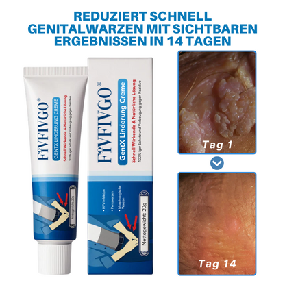 Fivfivgo® HPV-Creme zur Linderung genitaler Warzen