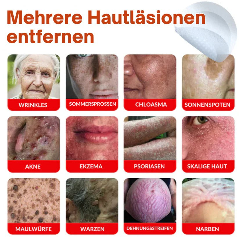 Oveallgo® MikroNadel PLUS Botanisches Tag-Clear-Pflaster 🇩🇪 Hergestellt in der Germany