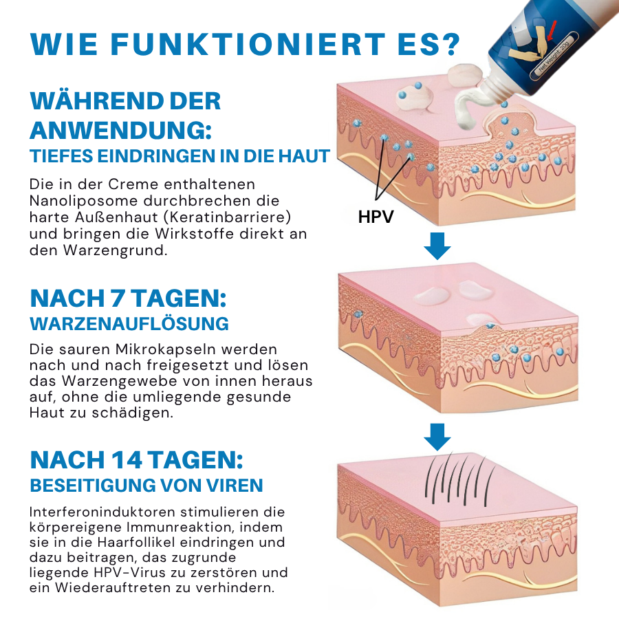 Fivfivgo® HPV-Creme zur Linderung genitaler Warzen
