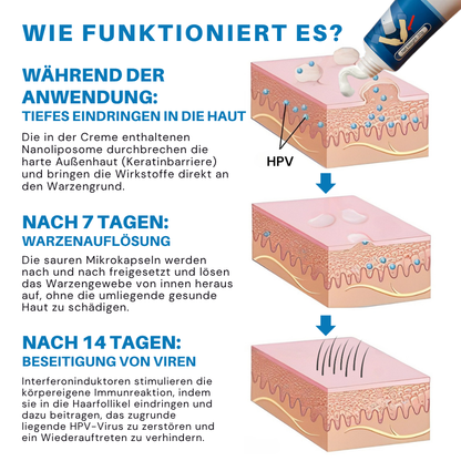 Fivfivgo® HPV-Creme zur Linderung genitaler Warzen